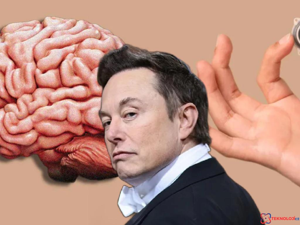 Felçli adam, Musk’ın beyin çipiyle Mario oynadı! İşte o anlar