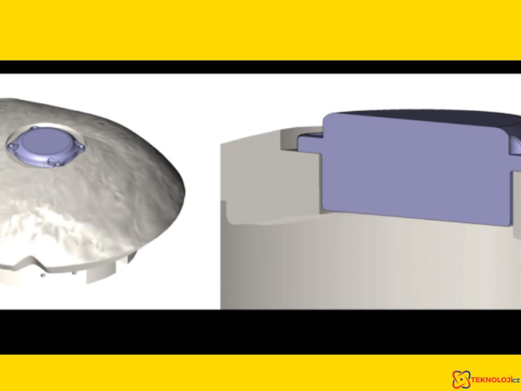 Neuralink İkinci İnsan Hastası Ameliyatı